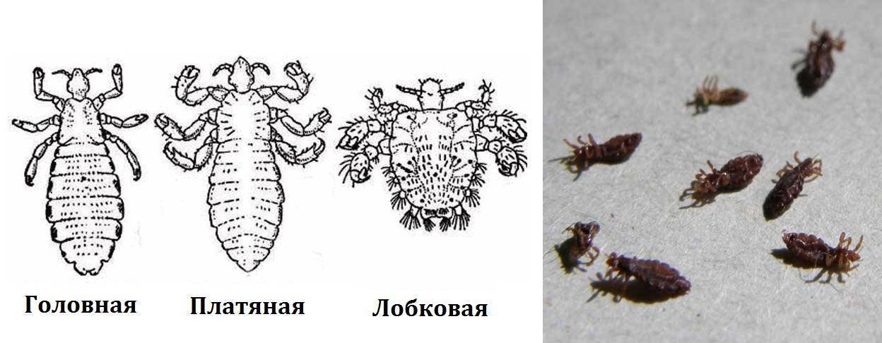 Блохи у человека причины появления и что необходимо знать