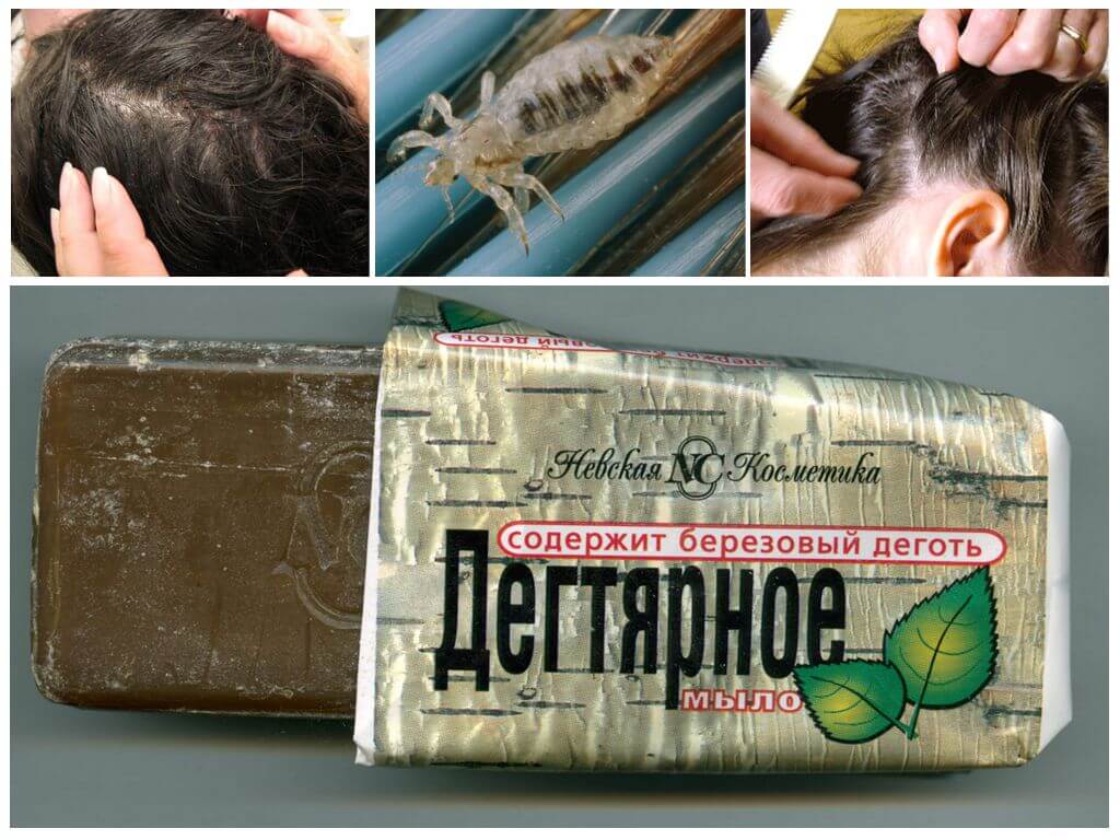 Дустовое мыло от вшей и гнид: применение, отзывы
