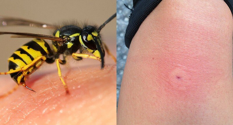 Когда и почему жалят пчелы. почему пчела умирает после укуса, извлечение пчелиного жала
