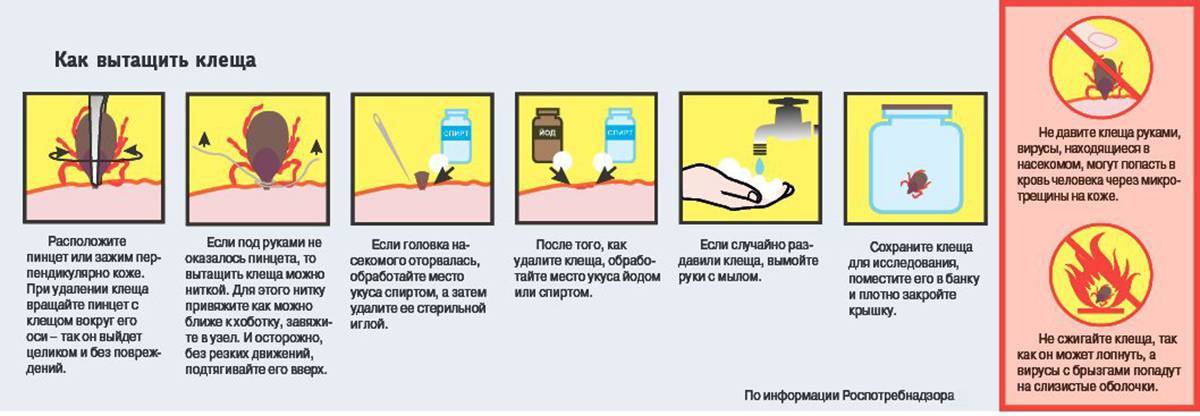 Как вытащить клеща в домашних условиях у человека – womanistka.ru