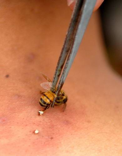 Причины по которым пчела умирает после того как ужалит
