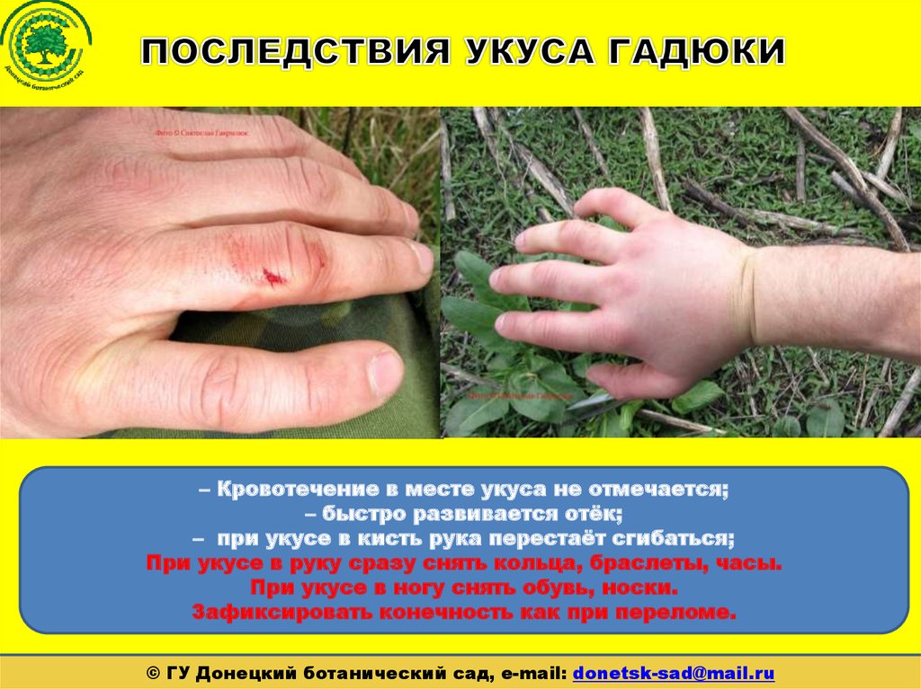 Воздействие укуса гадюки на организм человека