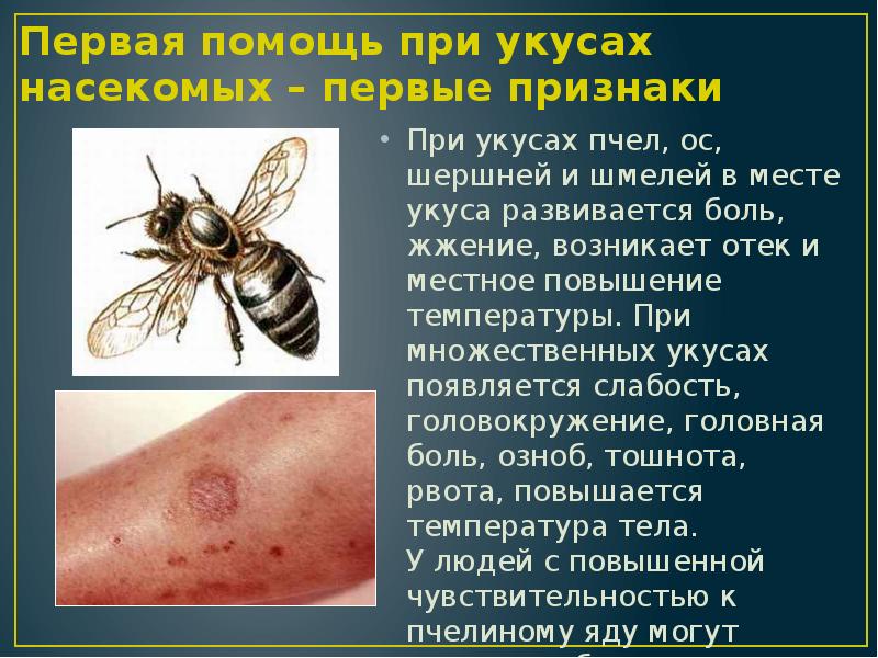Первая помощь при укусе пчелы (народные средства): чем лечить в домашних условиях