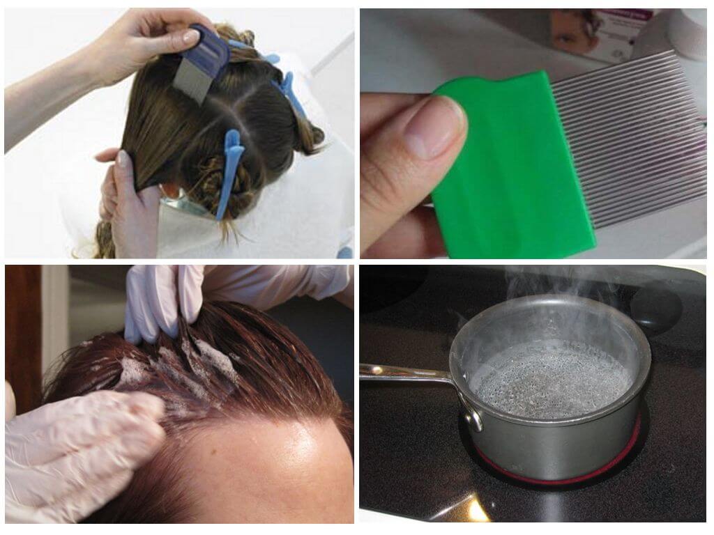 Вши на окрашенных волосах: могут ли появиться или завестись паразиты в волосах, как избавиться от них и народные средства для этого