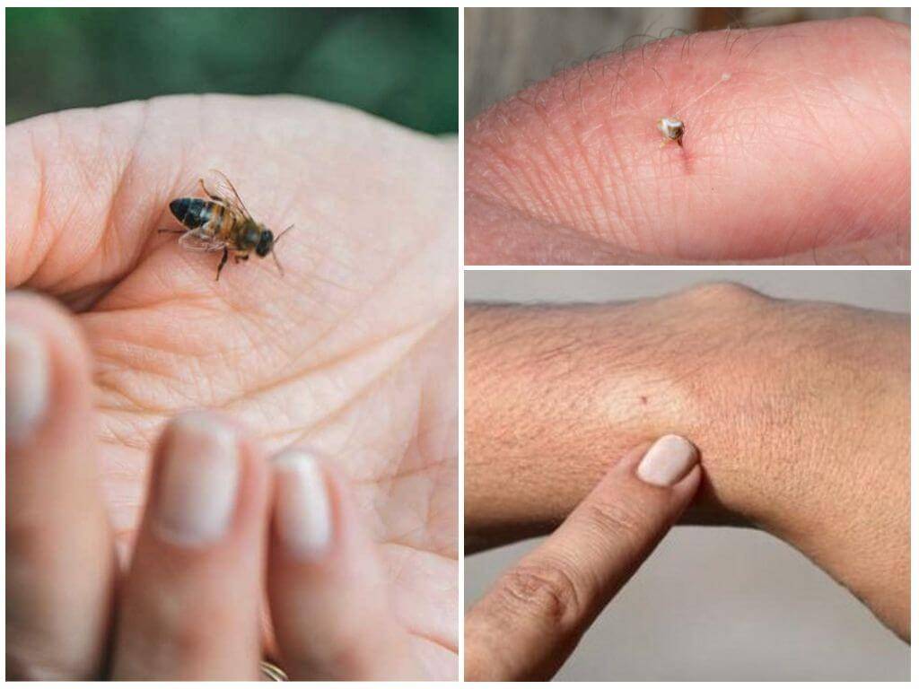 Есть ли у осы жало и оставляет ли она его после укуса