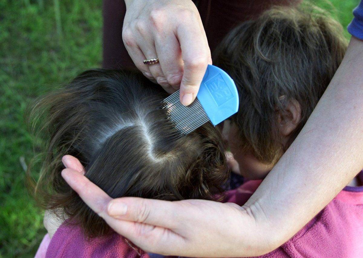 Как вывести блох у ребенка с длинными волосами