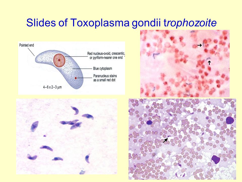 Toxoplasma gondii. Токсоплазма отряд. Токсоплазма гондии. Toxoplasma gondii морфология.