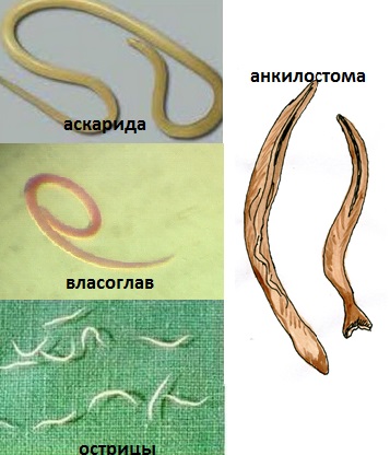 Виды глистов у человека картинки