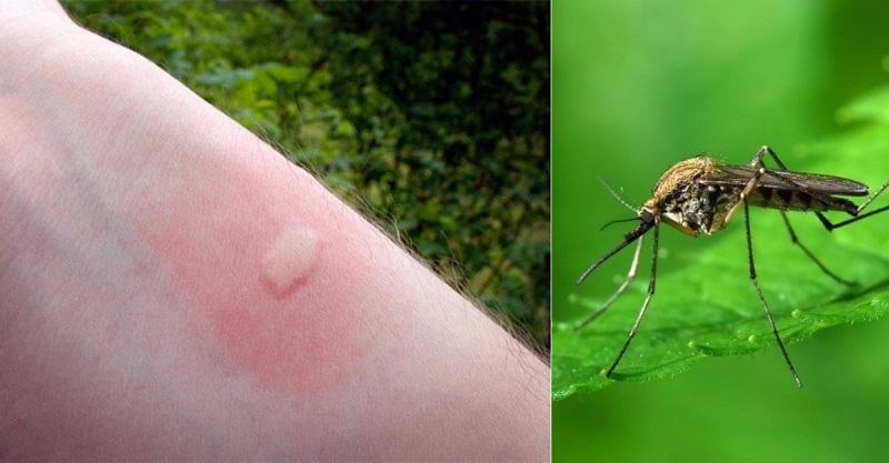 Что будет, если укусит малярийный комар и что нужно делать