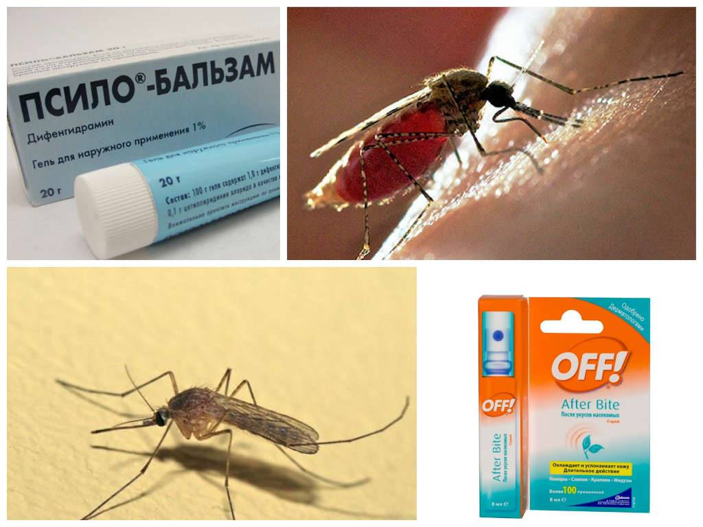 Что помогает от укусов. Средства при укусах комара. Раздражение от укуса комара.