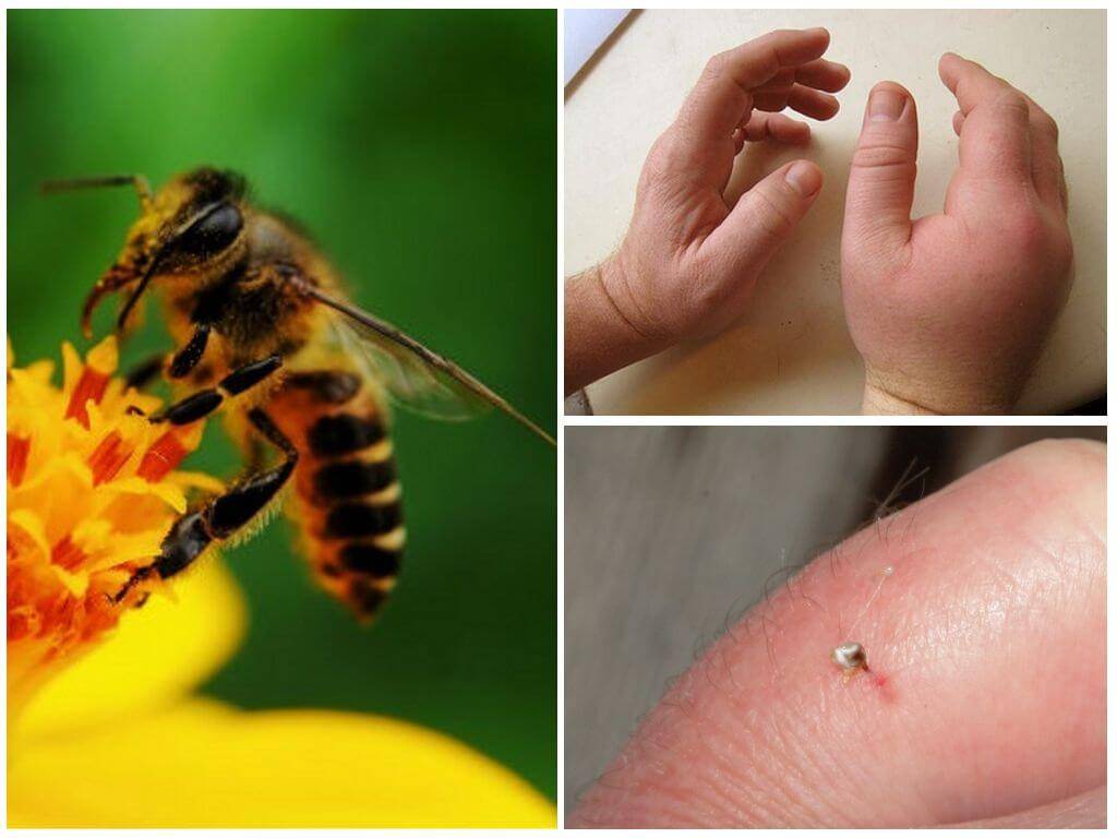 Жало пчелы. почему пчела умирает после укуса
