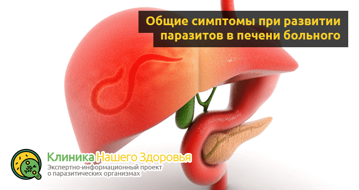 Виды паразитов в организме человека: классификация, описание, препараты для лечения | признаки, лечение и диагностика вгкб № 2