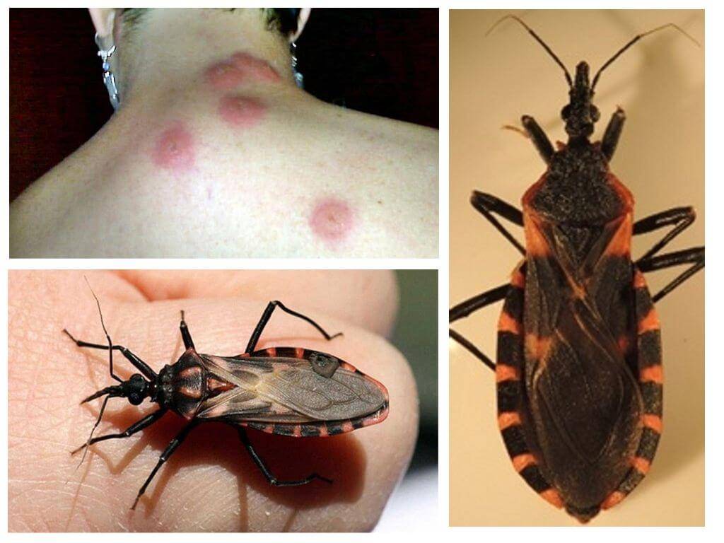 Триатомовые клопы – одни из самых опасных насекомых в мире