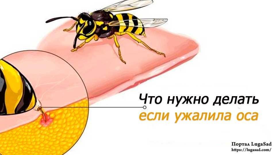Если укусила оса. первая помощь при укусе осы, пчелы, шмеля или шершня