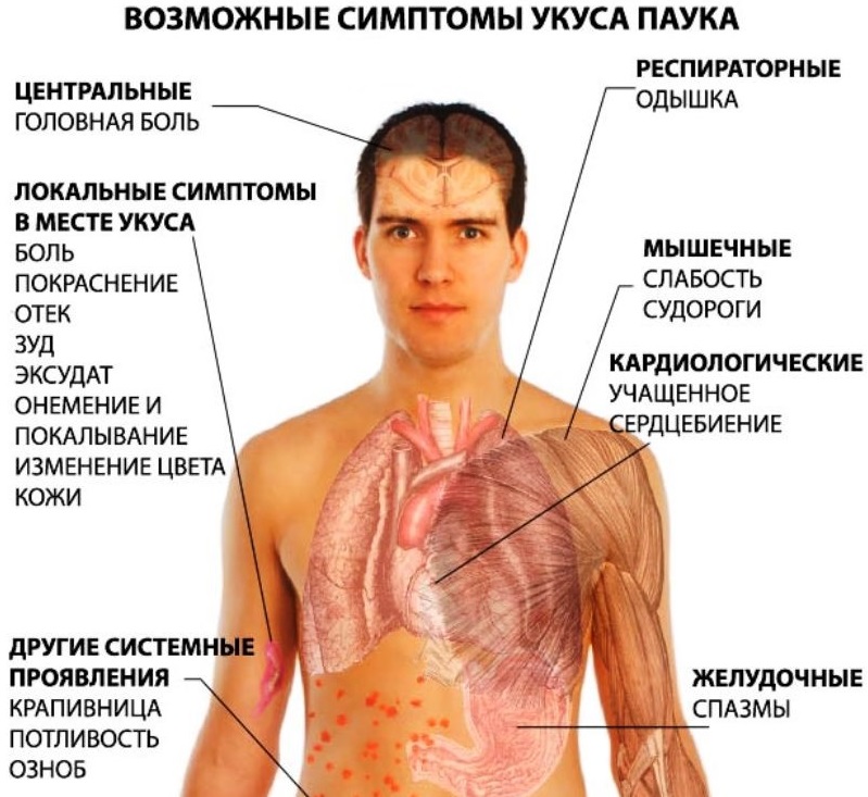Укусы блох: фото, симптомы, как выглядят на коже человека