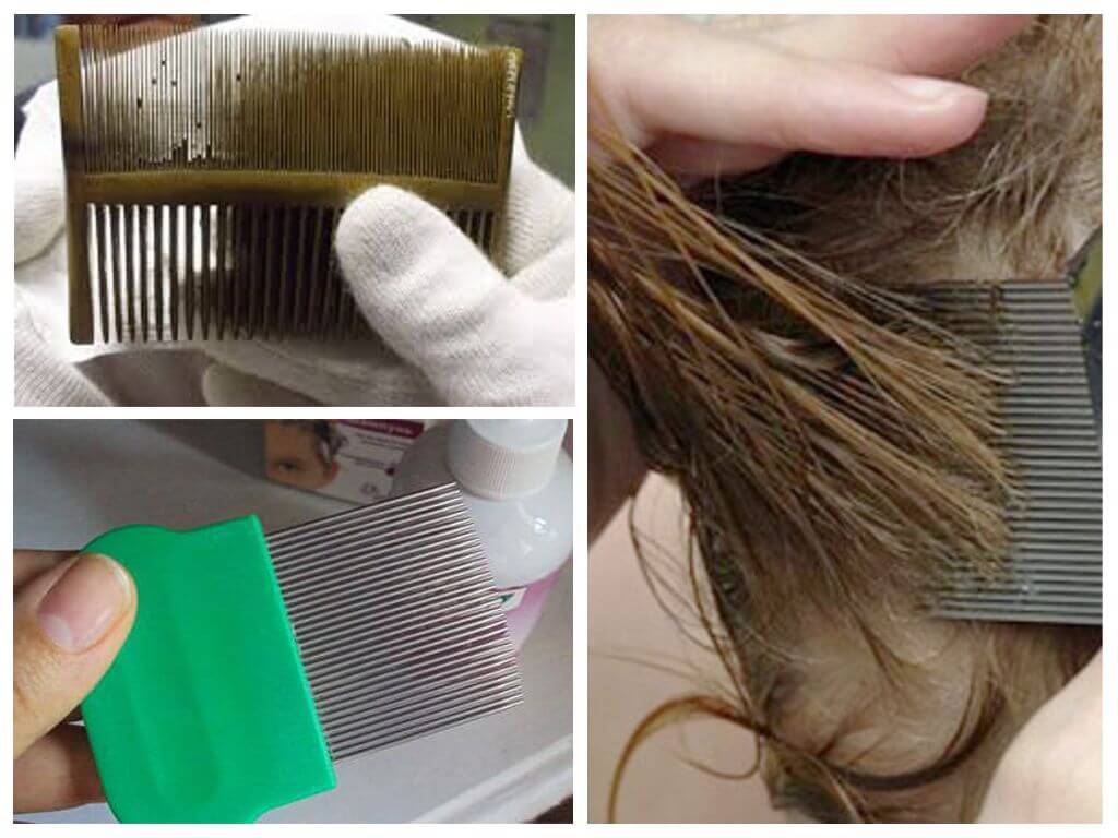Как вывести вши у ребенка с длинными волосами: способы лечения и профилактика гнид у девочек и мальчиков