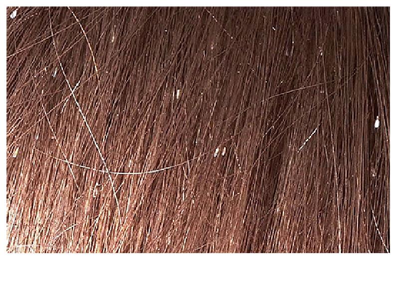 Живут ли вши на окрашенных волосах: убивает ли их краска?