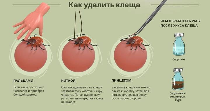 Врач-инфекционист наталья прохорова рассказала как действовать при укусе клеща