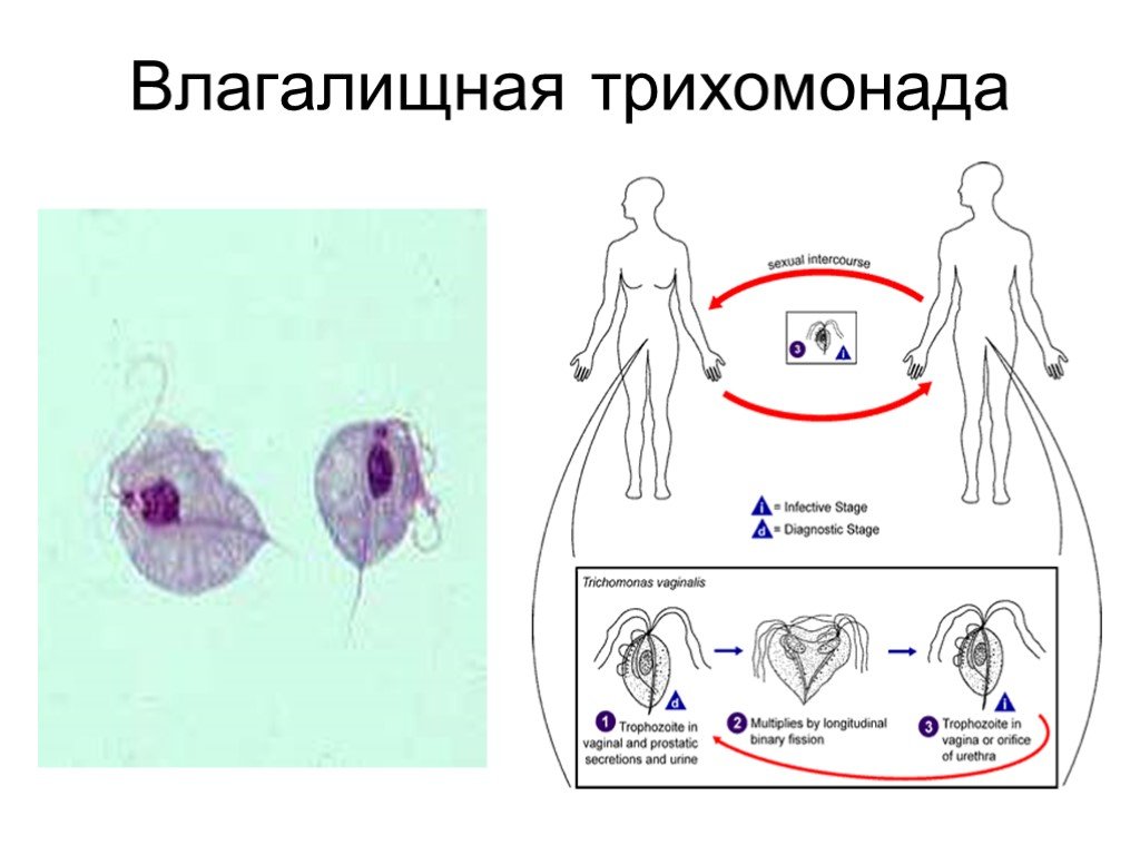 Половой трихомониаз | eurolab | паразитарные болезни