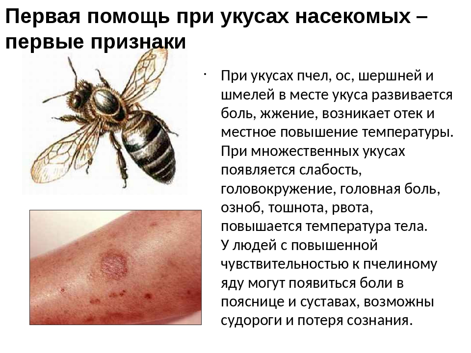 Укус осы: первая помощь, что делать в домашних условиях - pchela-info.ru