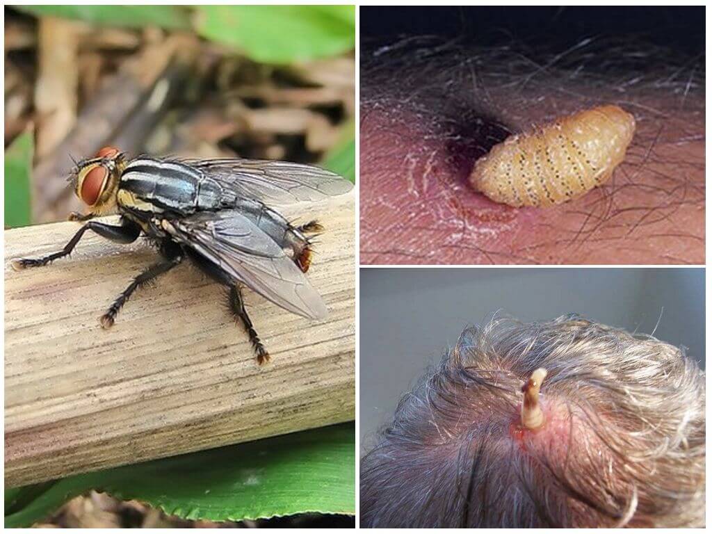 Личинки мухи в теле человека