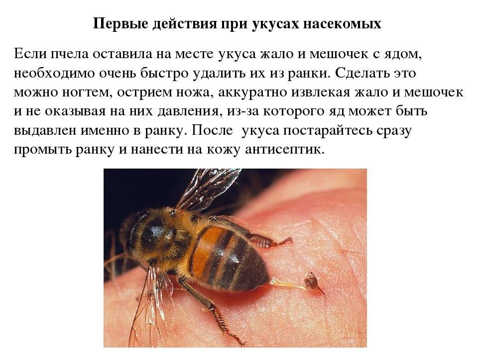 Нормальная и аллергическая реакция на укусы жалящих насекомых