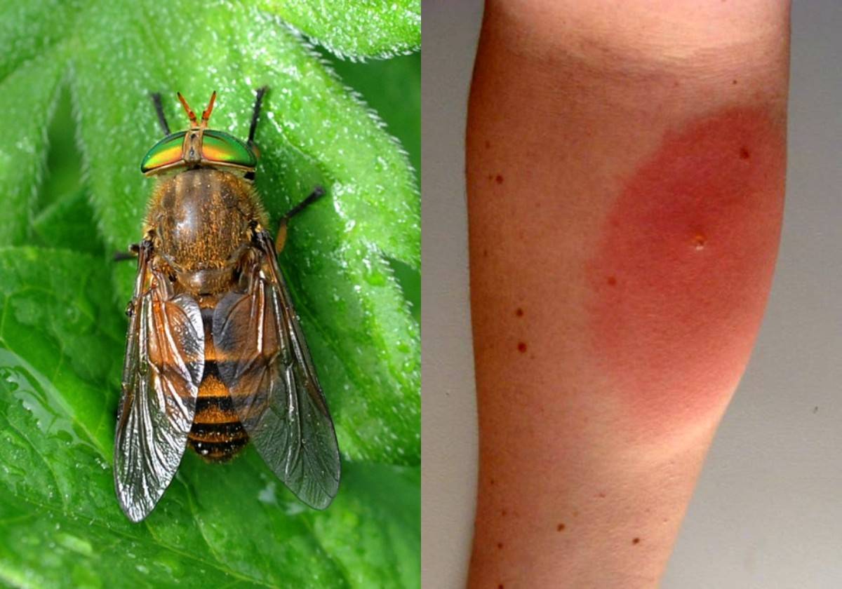 Насколько опасен укус мухи?