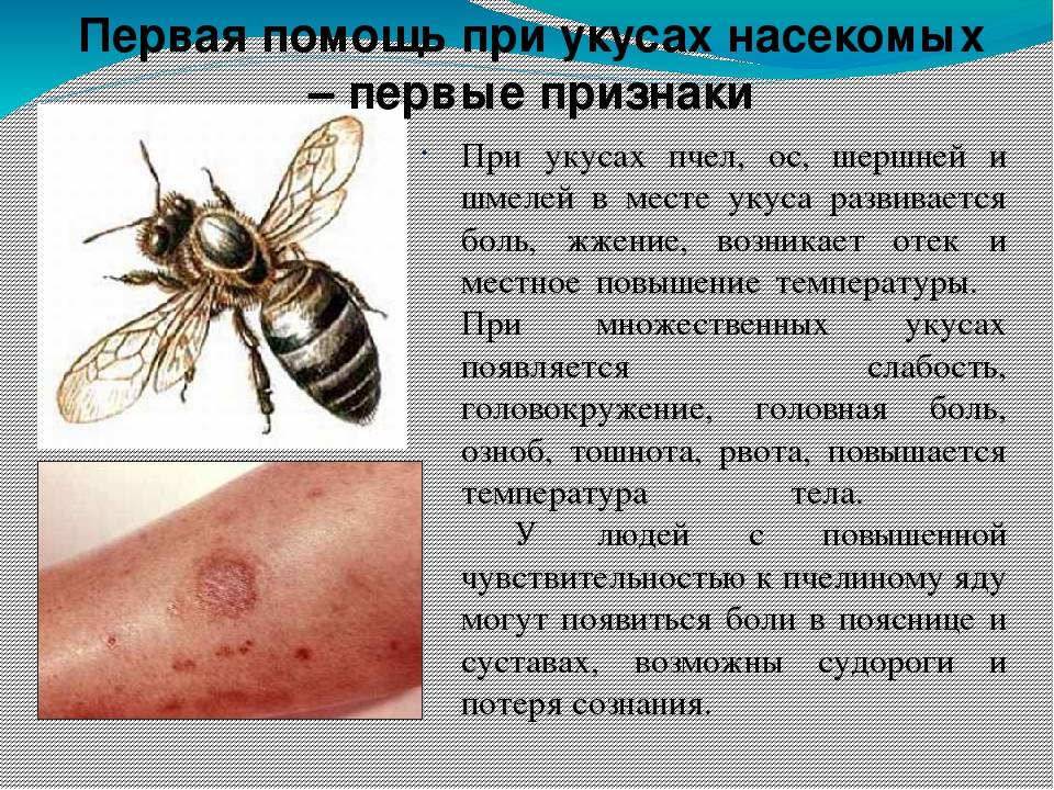 Аллергология: яд осы