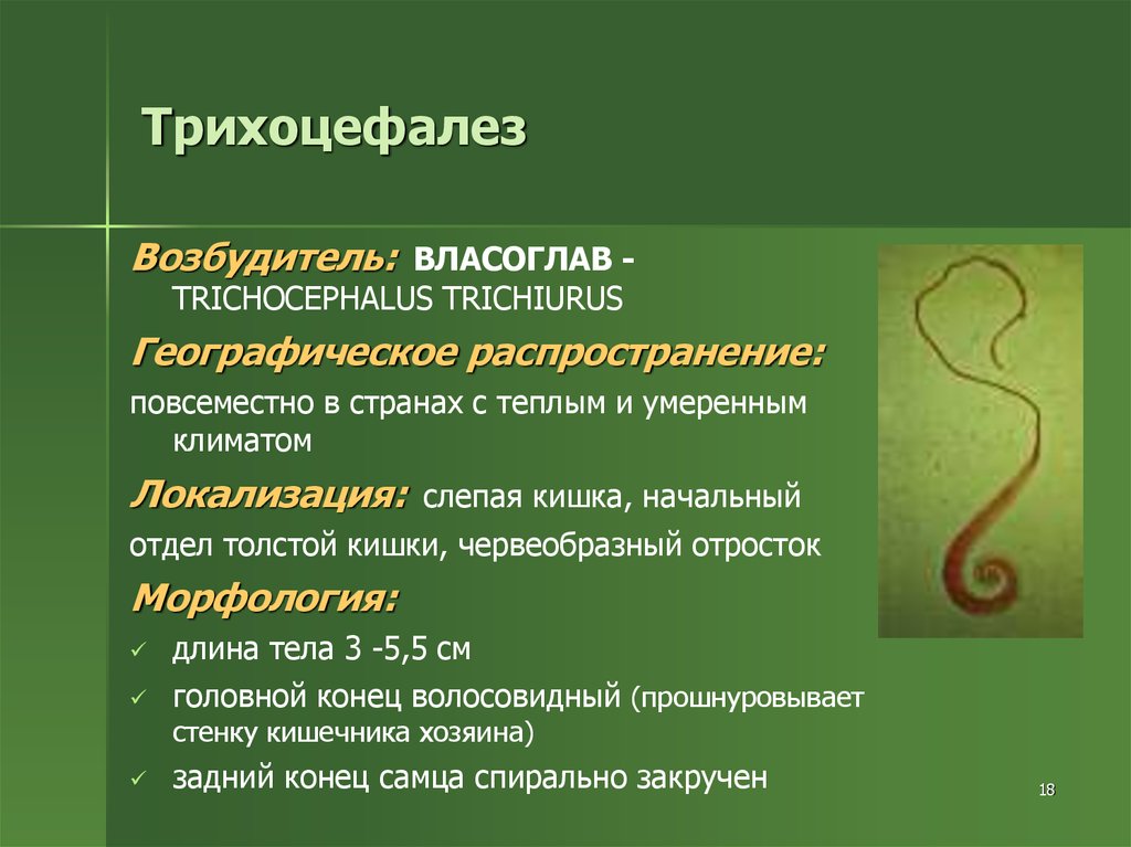 Синдром марфана