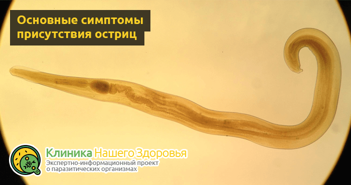 Аскаридоз у взрослых