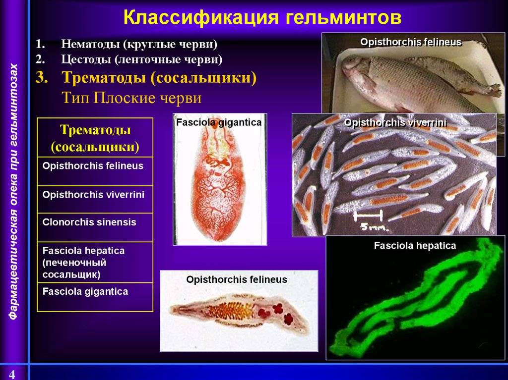 Гельминты рыб и как ими не 
 заразиться