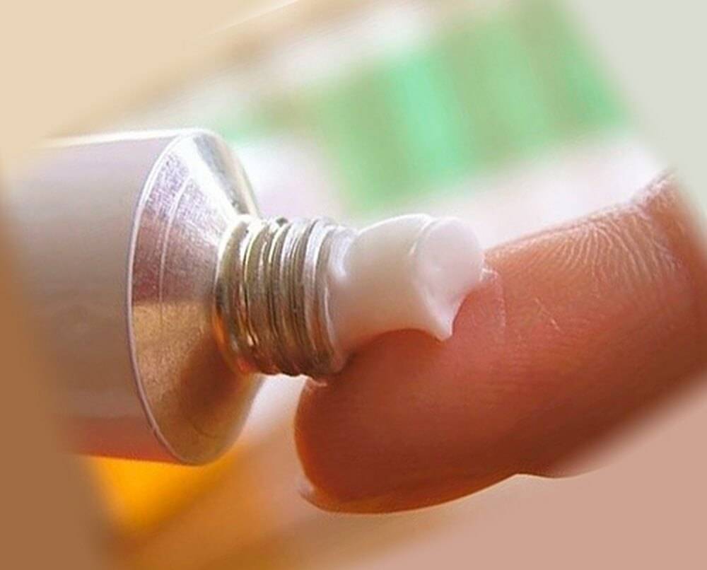 10 мазей от укусов постельных клопов: убираем зуд и воспаление
