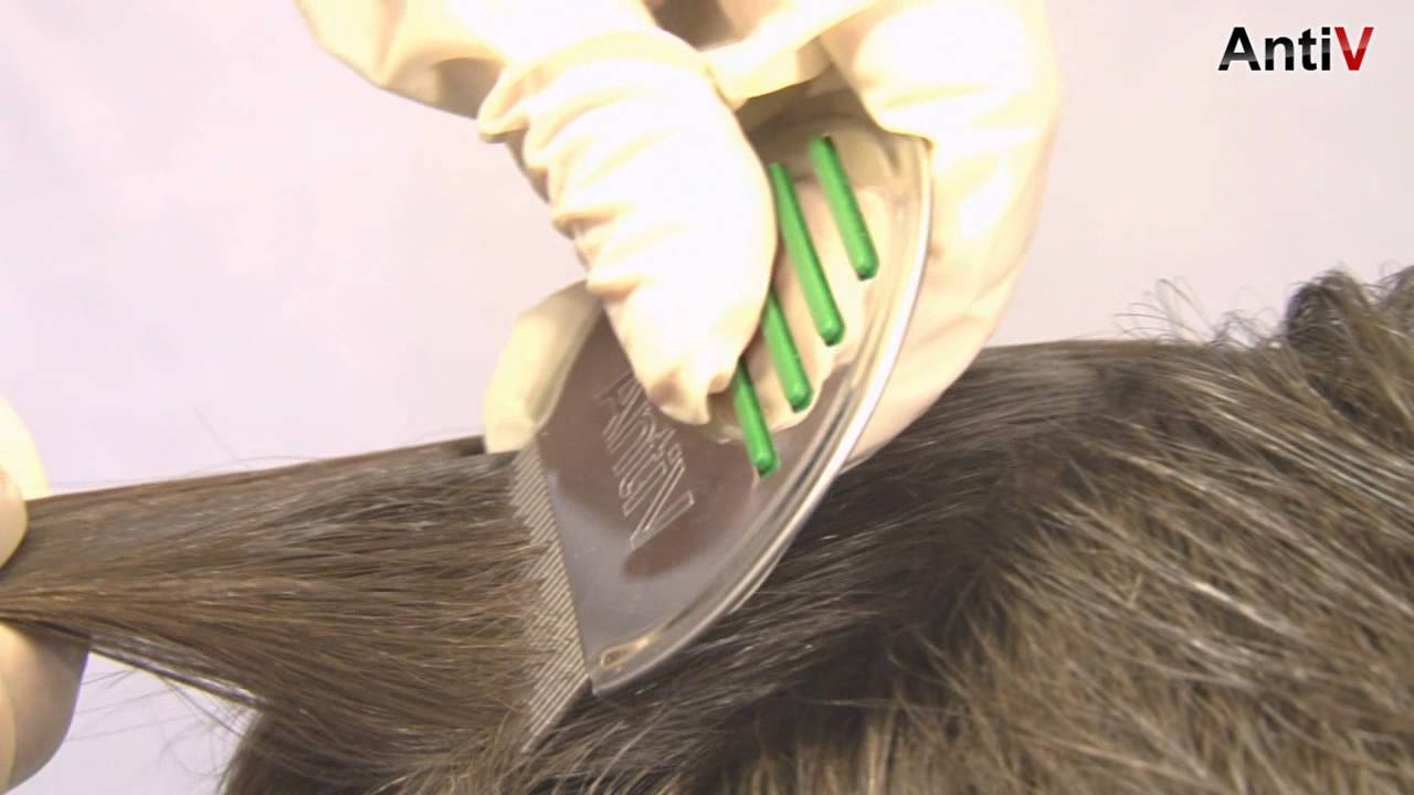 Как вычесать гнид и вшей правильно: гребнем с длинных волос
