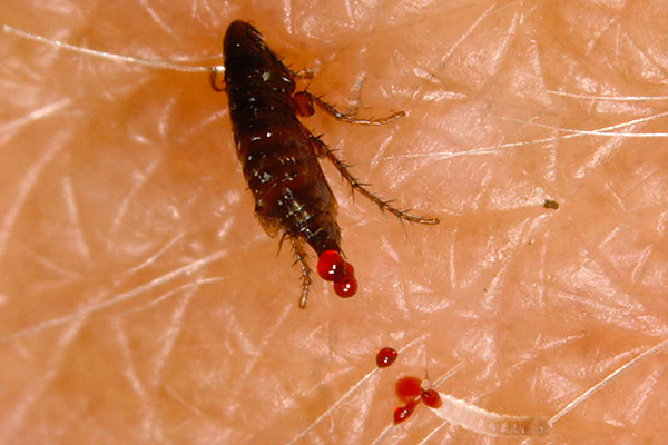 Кусаются ли домашние тараканы и как выглядят их укусы на теле человека