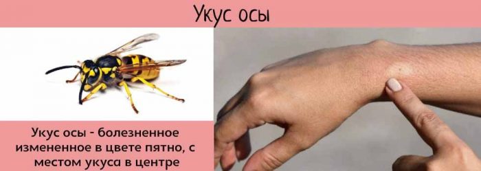 Укус осы или пчелы: первая помощь и лечение | дезинфекция, дезинсекция, дератизация - информационный портал