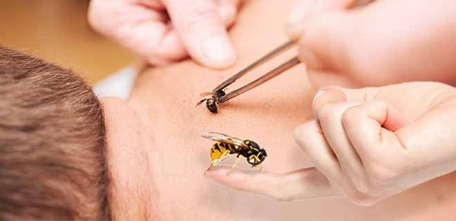 Апитерапия или лечение пчёлами. описание, схемы ужаливаний. отзывы и рекомендации