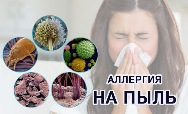 Аллергия на клещей домашней пыли: причины, симптомы и что делать