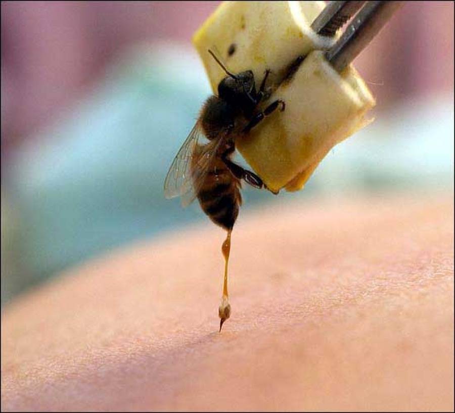 Укус пчелы, осы, что делать? первая помощь при укусе пчелы, осы, шершня. :: polismed.com