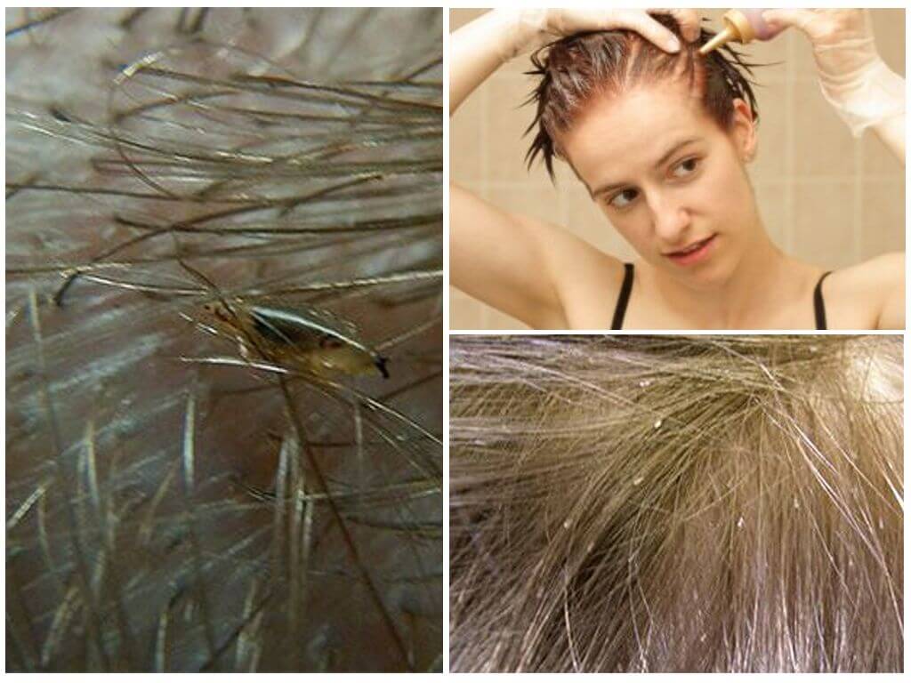 Живут ли вши на окрашенных волосах: воздействие краски