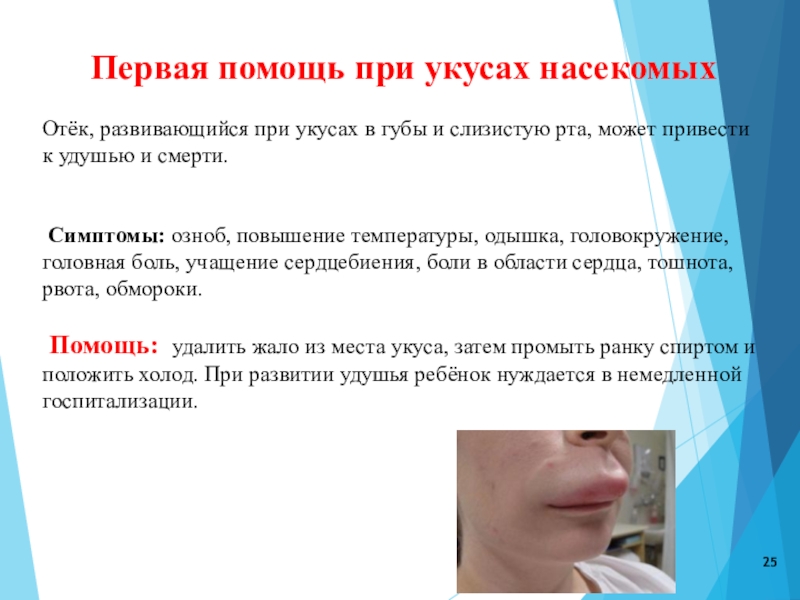 Что делать при попадании насекомого в ухо – dez service