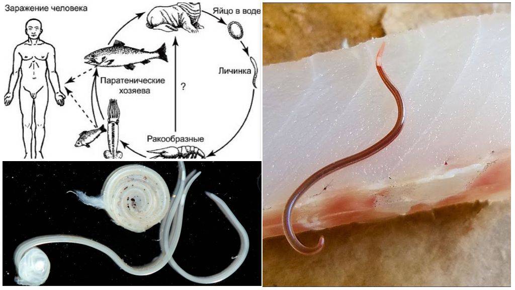 Глисты в рыбе – какие бывают, как выглядят и можно ли есть рыбу с гельминтами