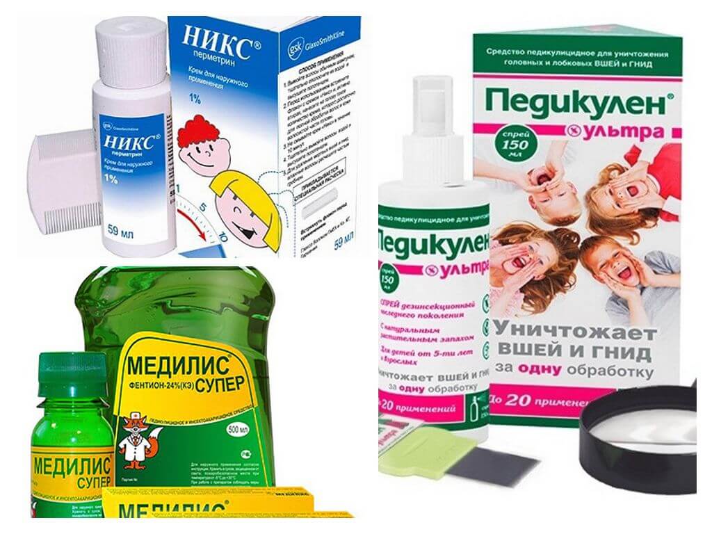 Педикулёз тела