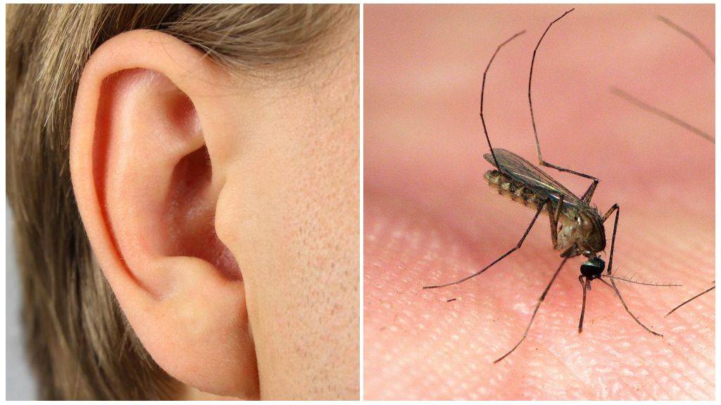 Что делать при попадании насекомого в ухо