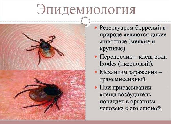 Боррелиоз - симптомы, лечение, последствия, фото боррелиоза