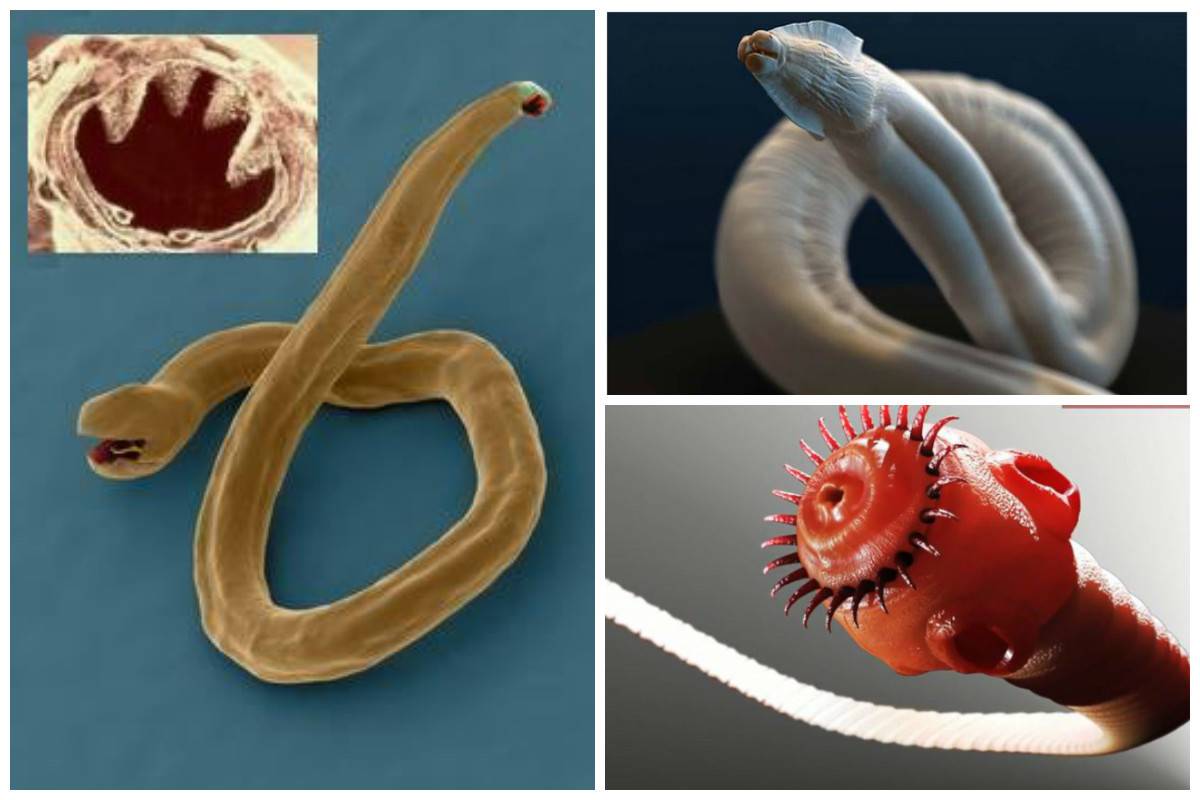 Какие черви обитают в организме человека