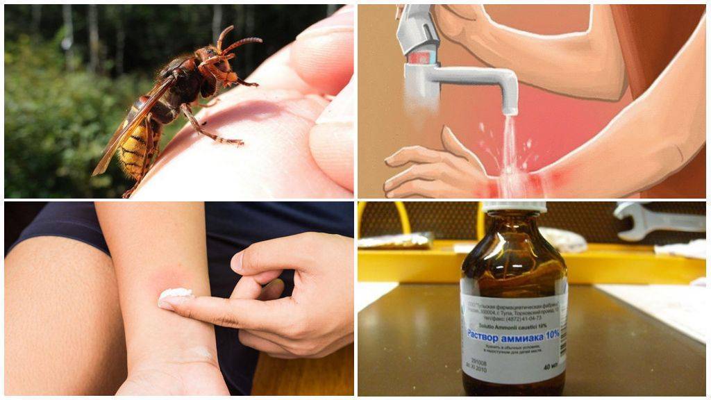 Что делать при аллергии на укус осы?