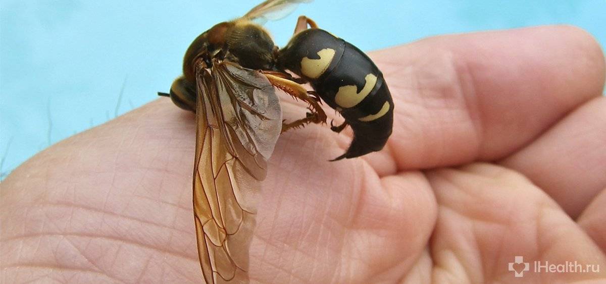 Чем полезен укус осы для человека