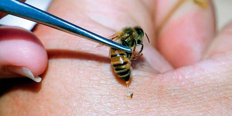 Жало пчелы: как выглядит, где находится, схема ужаливания