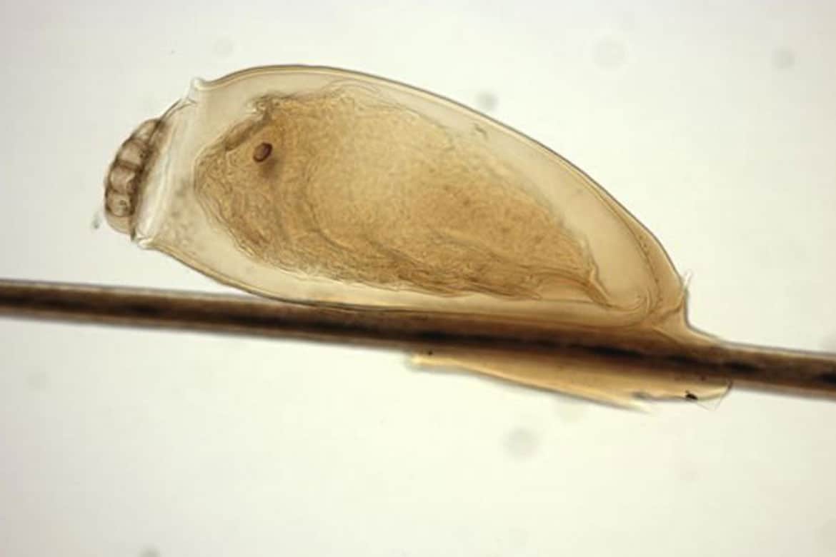 Что такое вши и гниды, как они выглядят под микроскопом