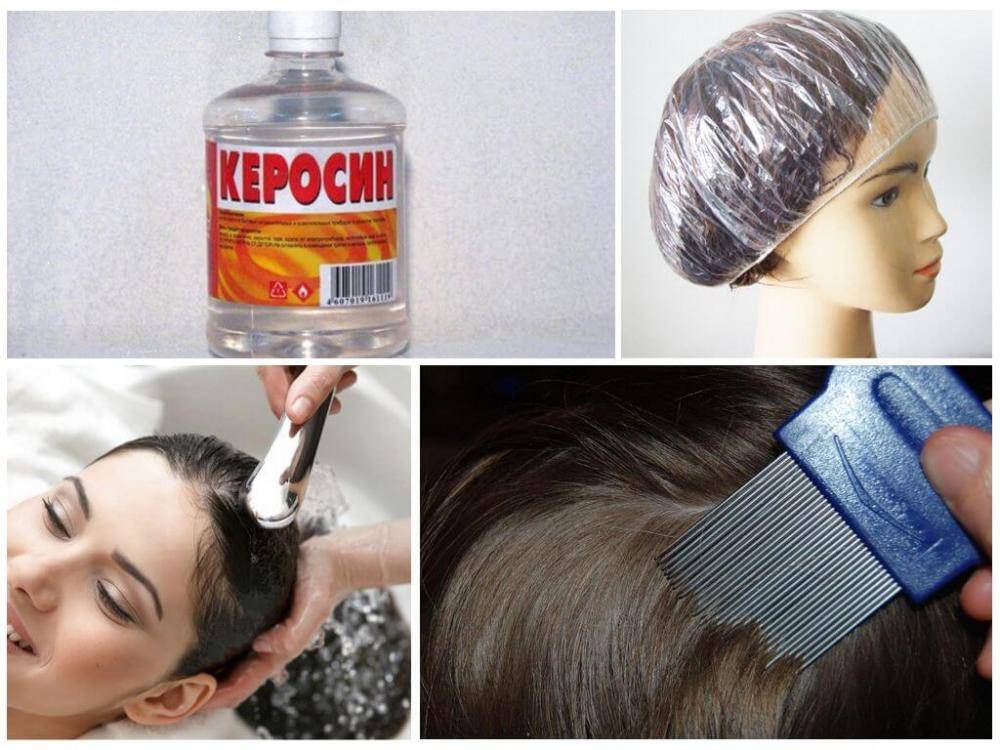 Лечение болячек и ранок на коже головы — причины появления корок в волосах - клиника «доктор волос»